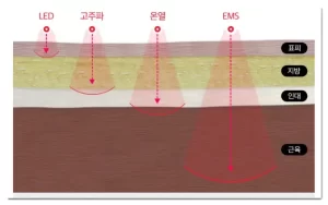 휴그랩 리즈라인 적용기술