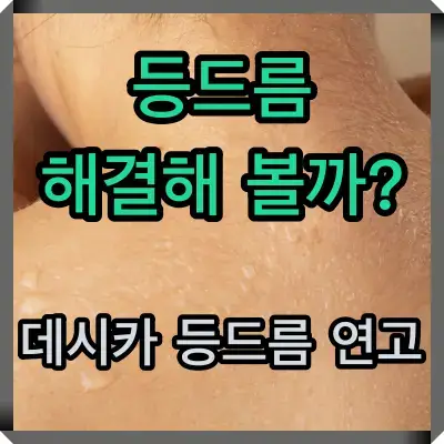 데시카 등드름 연고 썸네일