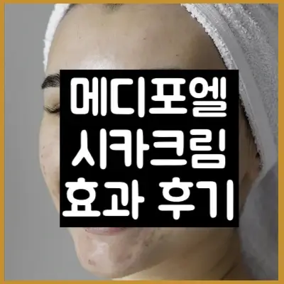 메디포엘 시카크림