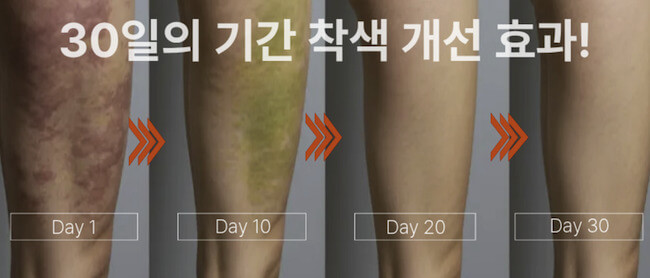 착색개선 30일간의 효과 