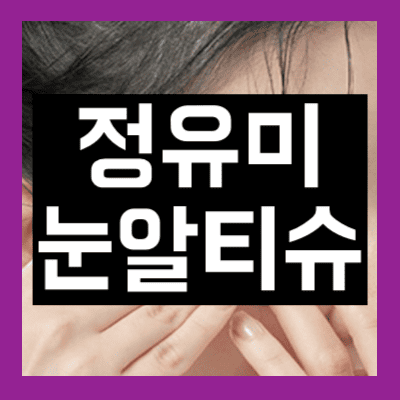 정유미 눈알티슈